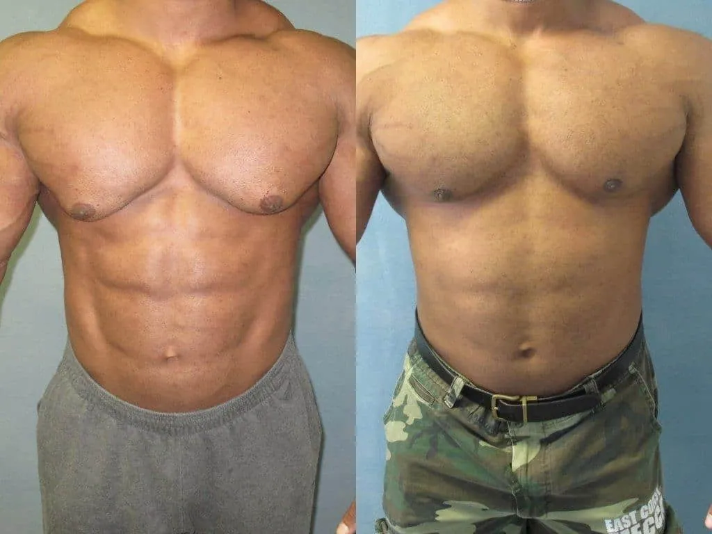 Beitragsbild zum Artikel: Nolvadex (Tamoxifen-Citrat): Fluch oder Segen für Bodybuilder?