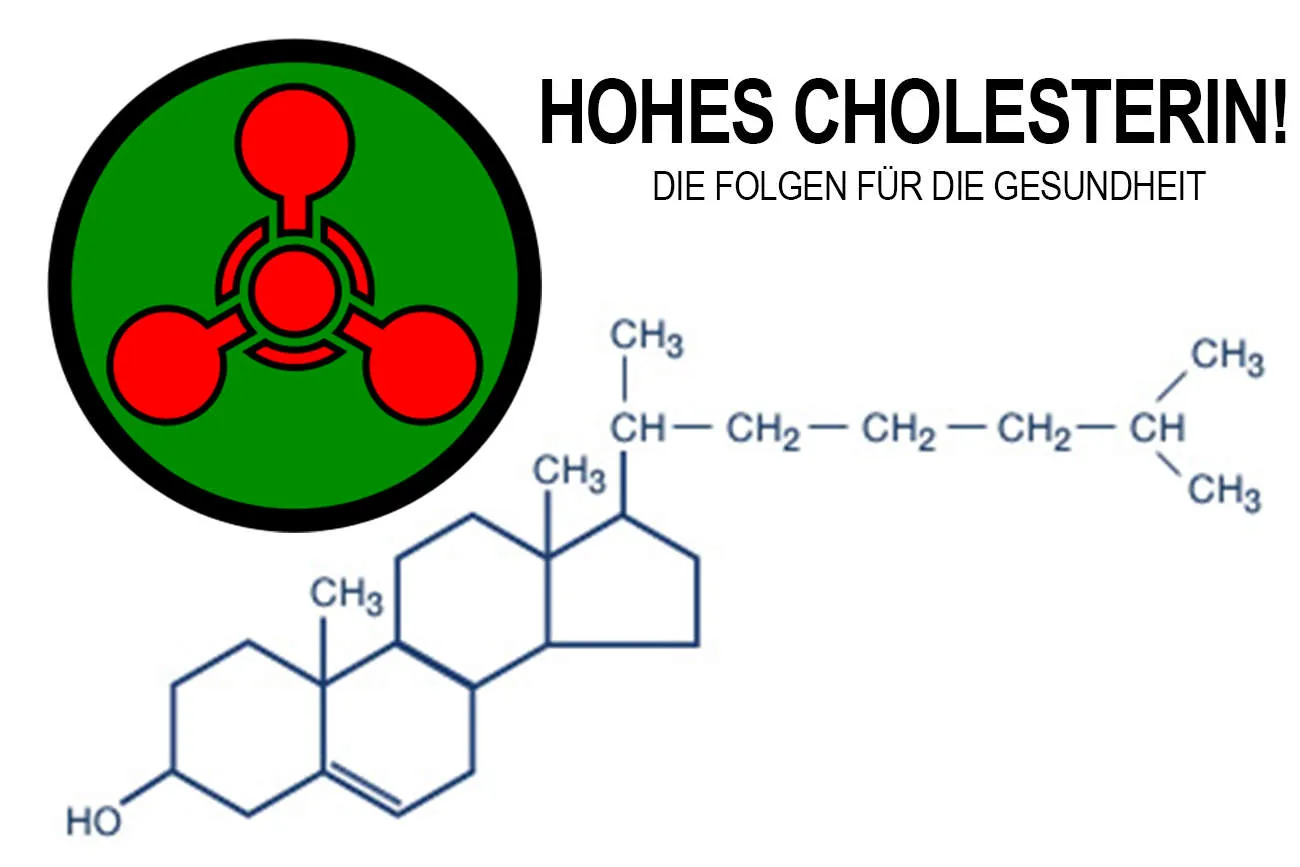 Beitragsbild zum Artikel: Hoher Cholesterinspiegel, Die Folgen für die Gesundheit